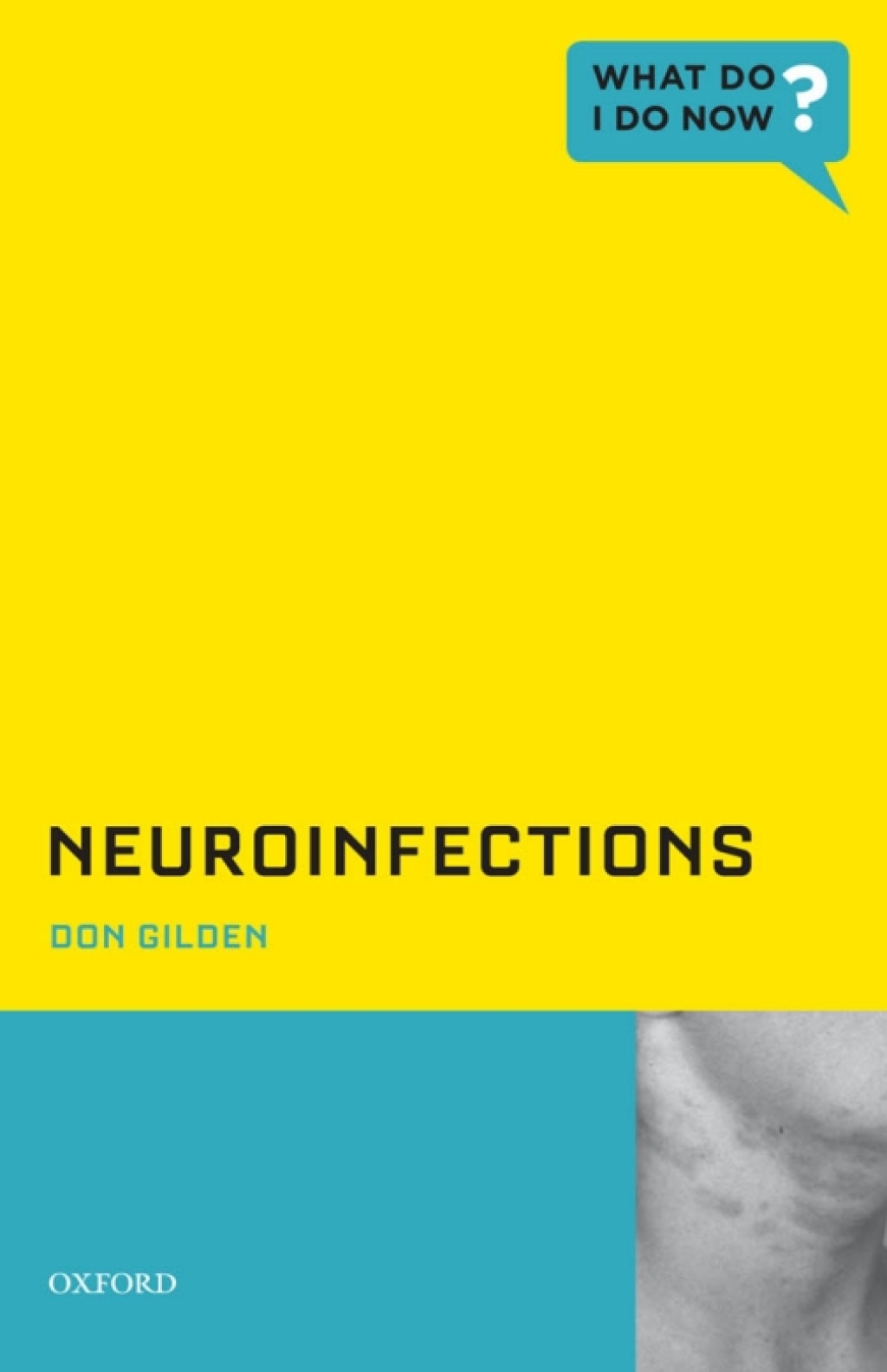 Neuroinfections  â€“ PDF/EPUB Version Downloadable