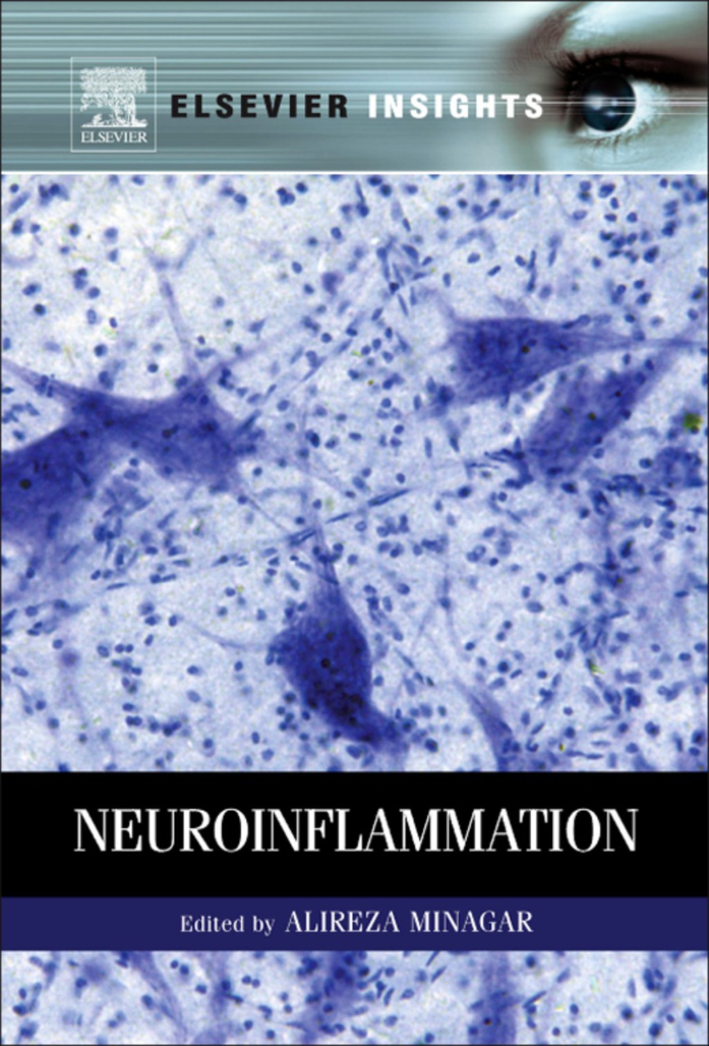 Neuroinflammation  â€“ PDF/EPUB Version Downloadable
