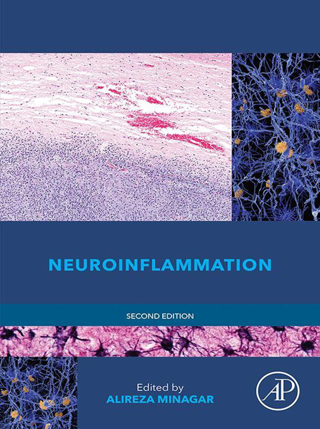Neuroinflammation 2nd Edition â€“ PDF/EPUB Version Downloadable