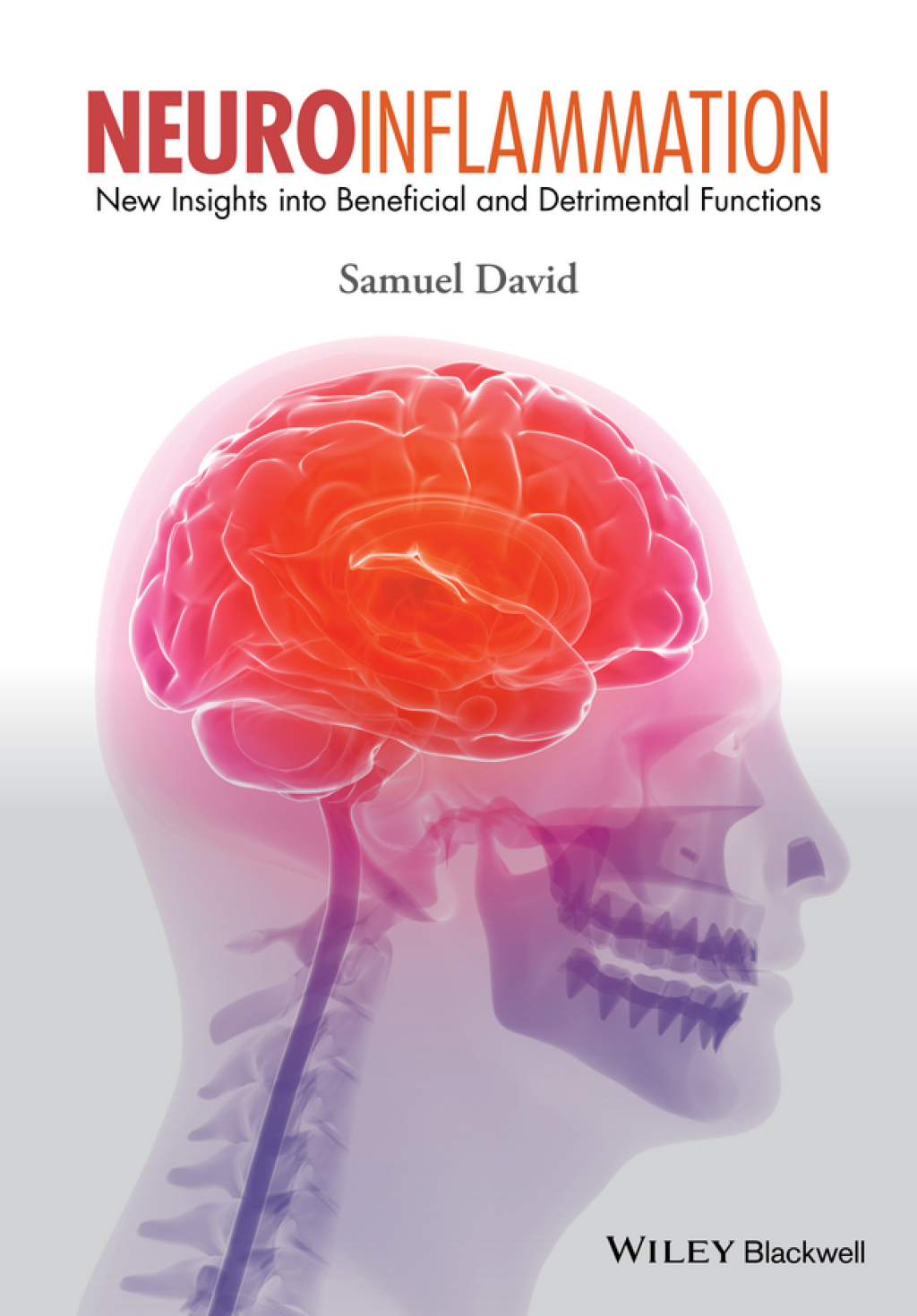 Neuroinflammation New Insights into Beneficial and Detrimental Functions 1st Edition â€“ PDF/EPUB Version Downloadable