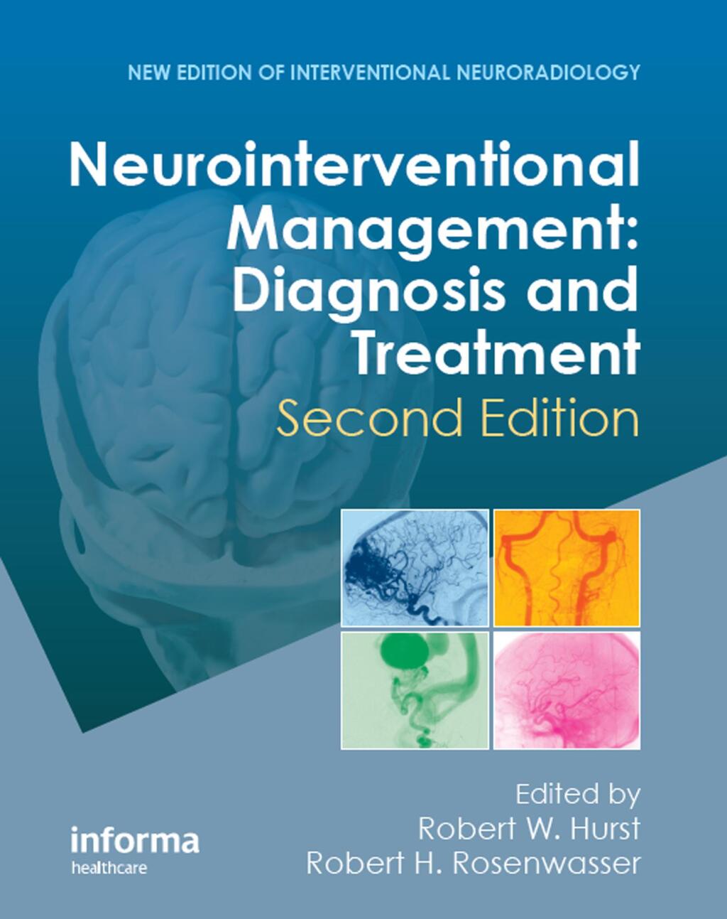 Neurointerventional Management Diagnosis and Treatment 2nd Edition â€“ PDF/EPUB Version Downloadable