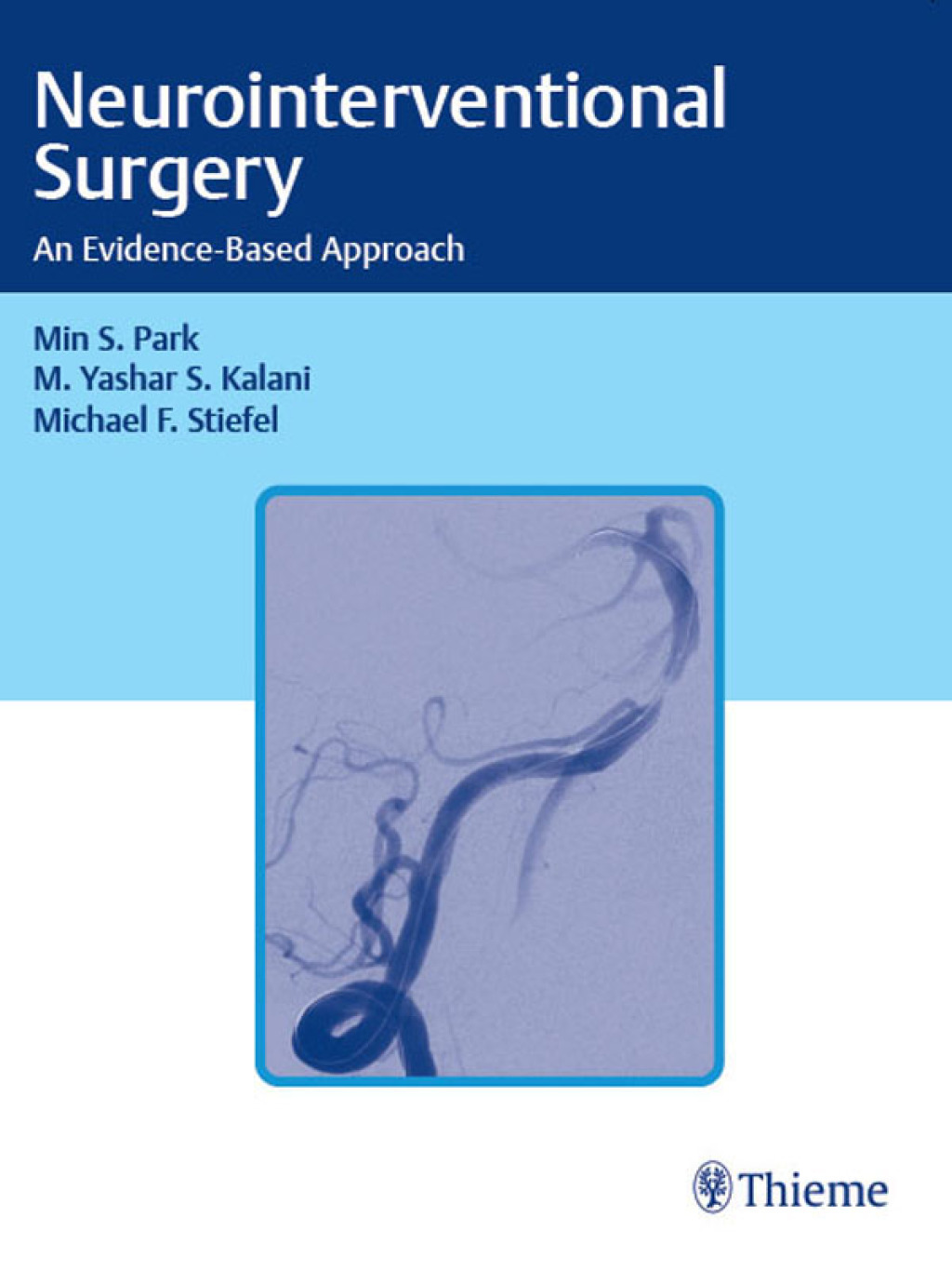 Neurointerventional Surgery An Evidence-Based Approach 1st Edition â€“ PDF/EPUB Version Downloadable