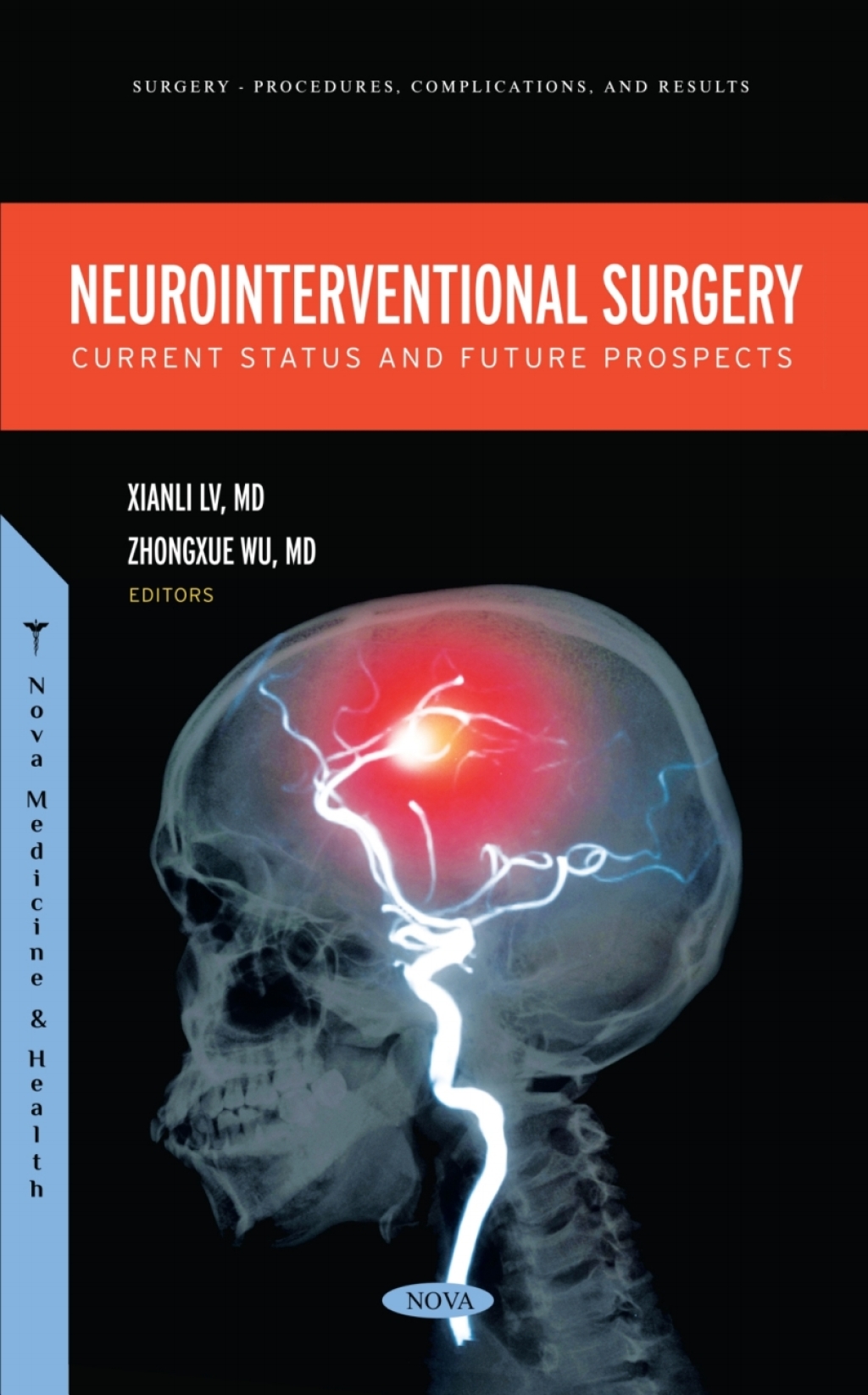 Neurointerventional Surgery: Current Status and Future Prospects  â€“ PDF/EPUB Version Downloadable