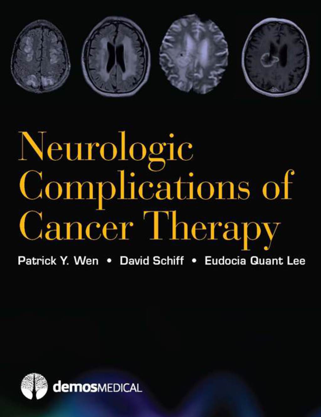 Neurologic Complications of Cancer Therapy 1st Edition â€“ PDF/EPUB Version Downloadable
