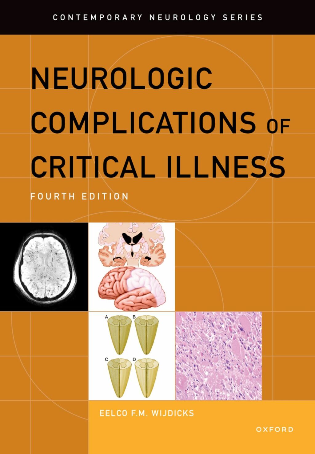 Neurologic Complications of Critical Illness 4th Edition – PDF/EPUB Version Downloadable