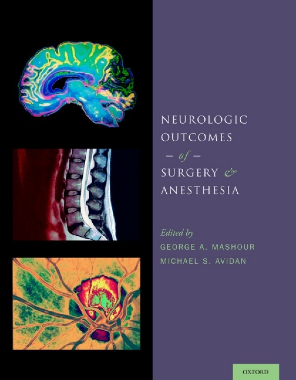 Neurologic Outcomes of Surgery and Anesthesia 1st Edition â€“ PDF/EPUB Version Downloadable