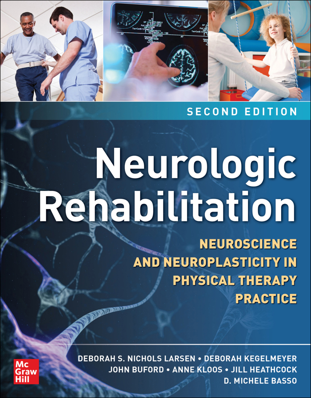 Neurologic Rehabilitation: Neuroscience and Neuroplasticity in Physical Therapy Practice 2nd Edition â€“ PDF/EPUB Version Downloadable
