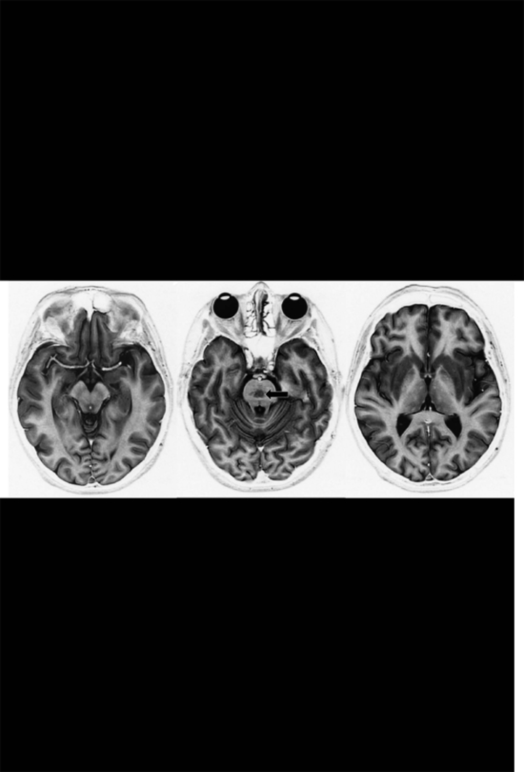 Neurological Case Histories Case Histories in Acute Neurology and the Neurology of General Medicine  â€“ PDF/EPUB Version Downloadable