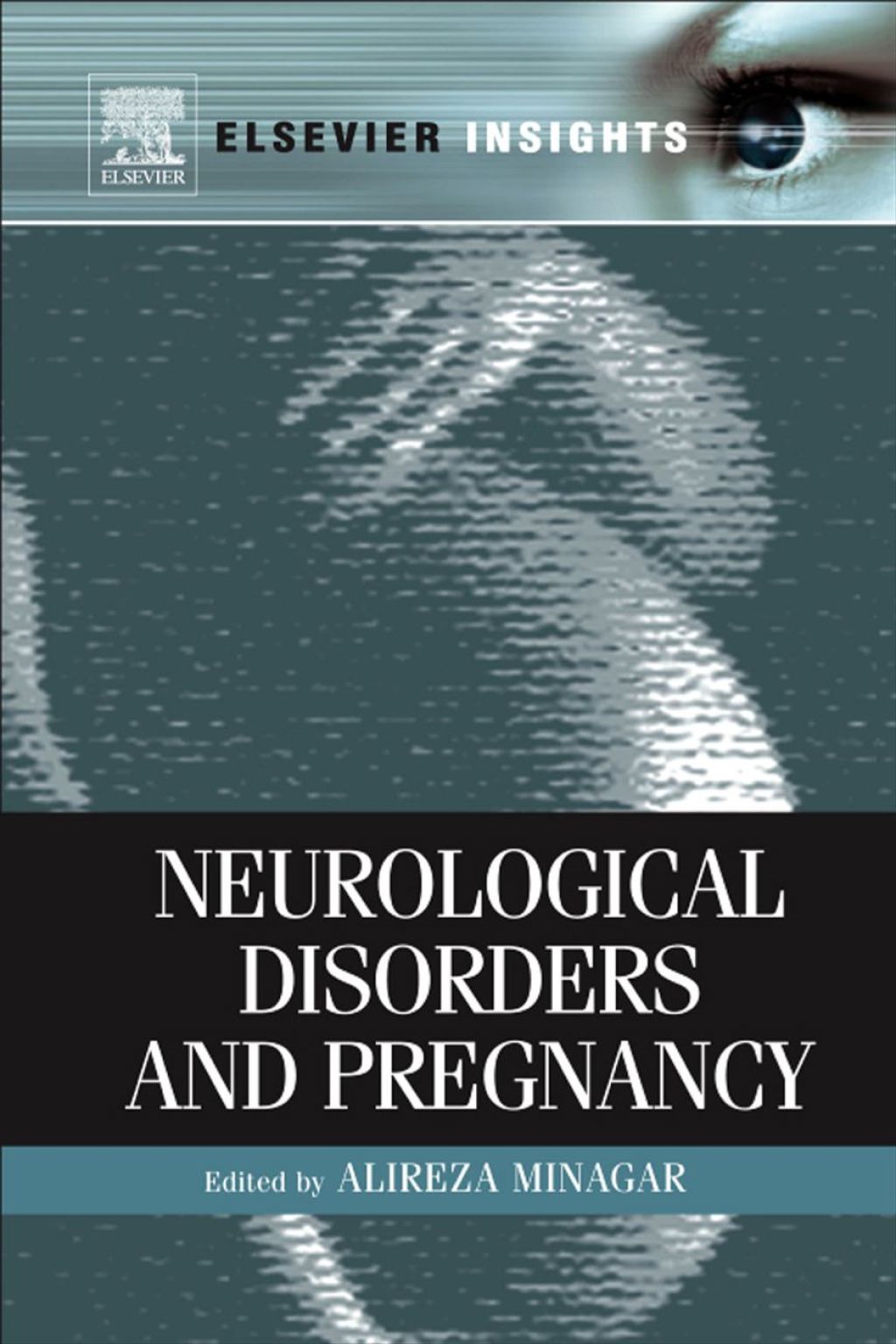 Neurological Disorders and Pregnancy  â€“ PDF/EPUB Version Downloadable