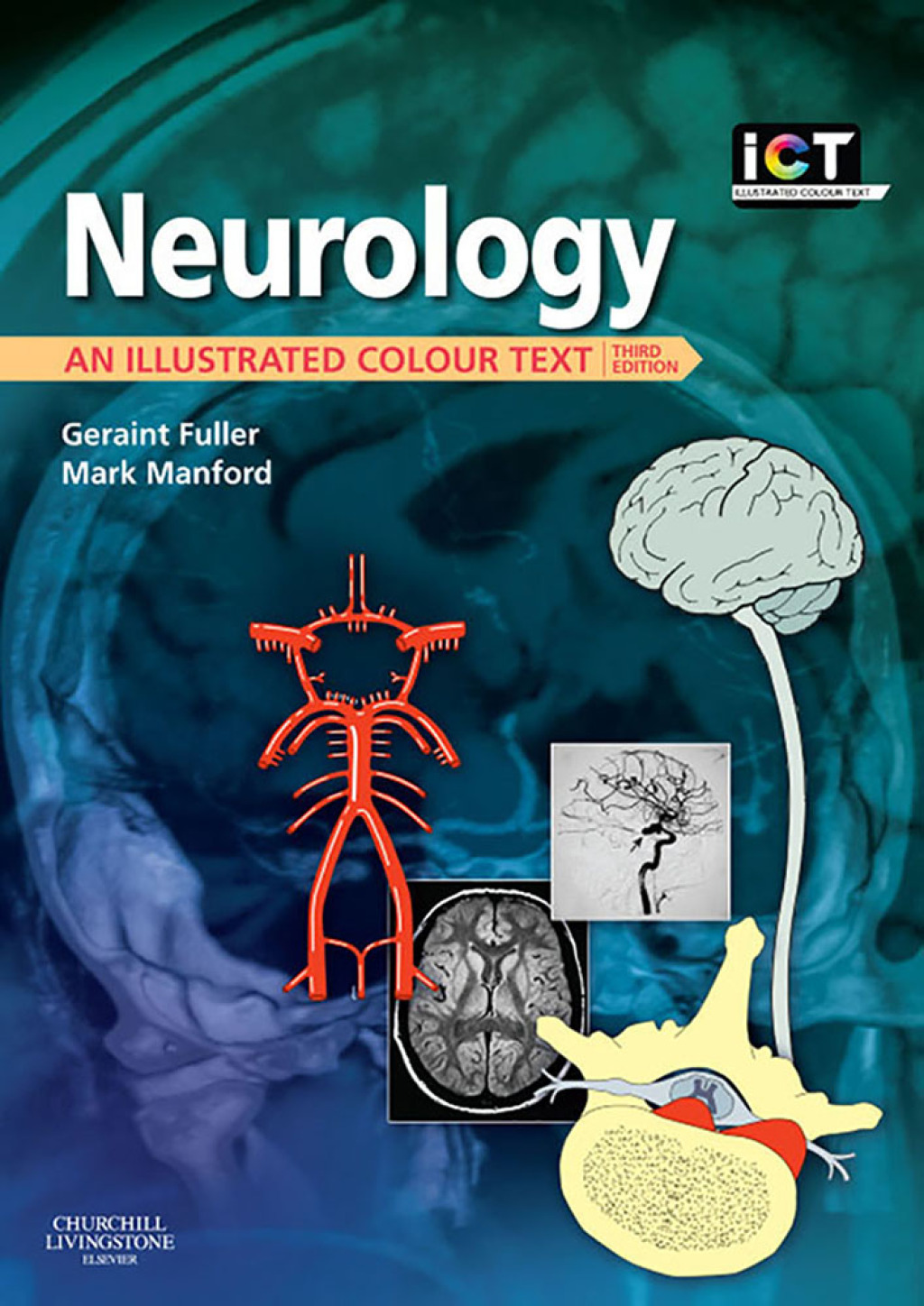 Neurology An Illustrated Colour Text 3rd Edition â€“ PDF/EPUB Version Downloadable