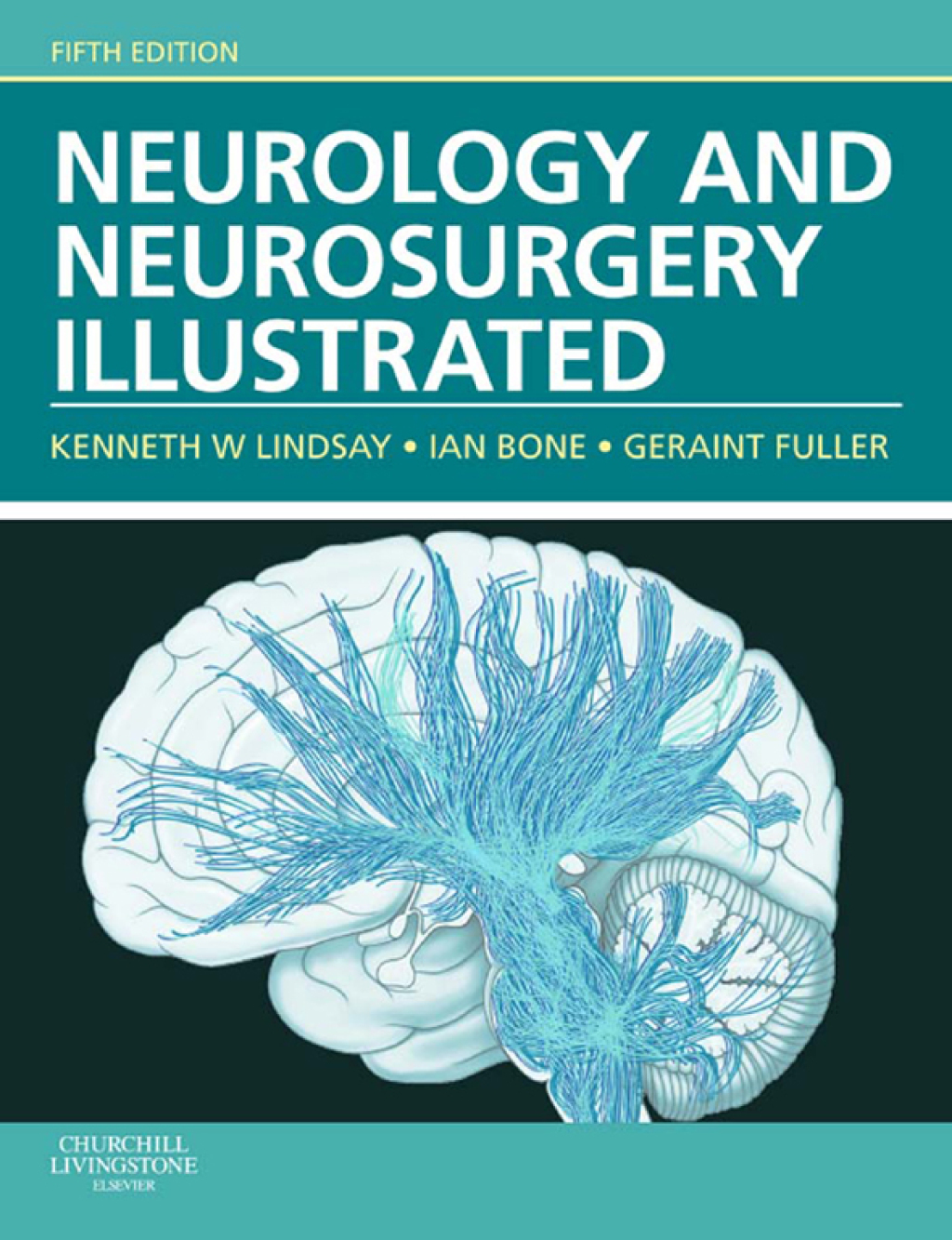 Neurology and Neurosurgery Illustrated 5th Edition â€“ PDF/EPUB Version Downloadable