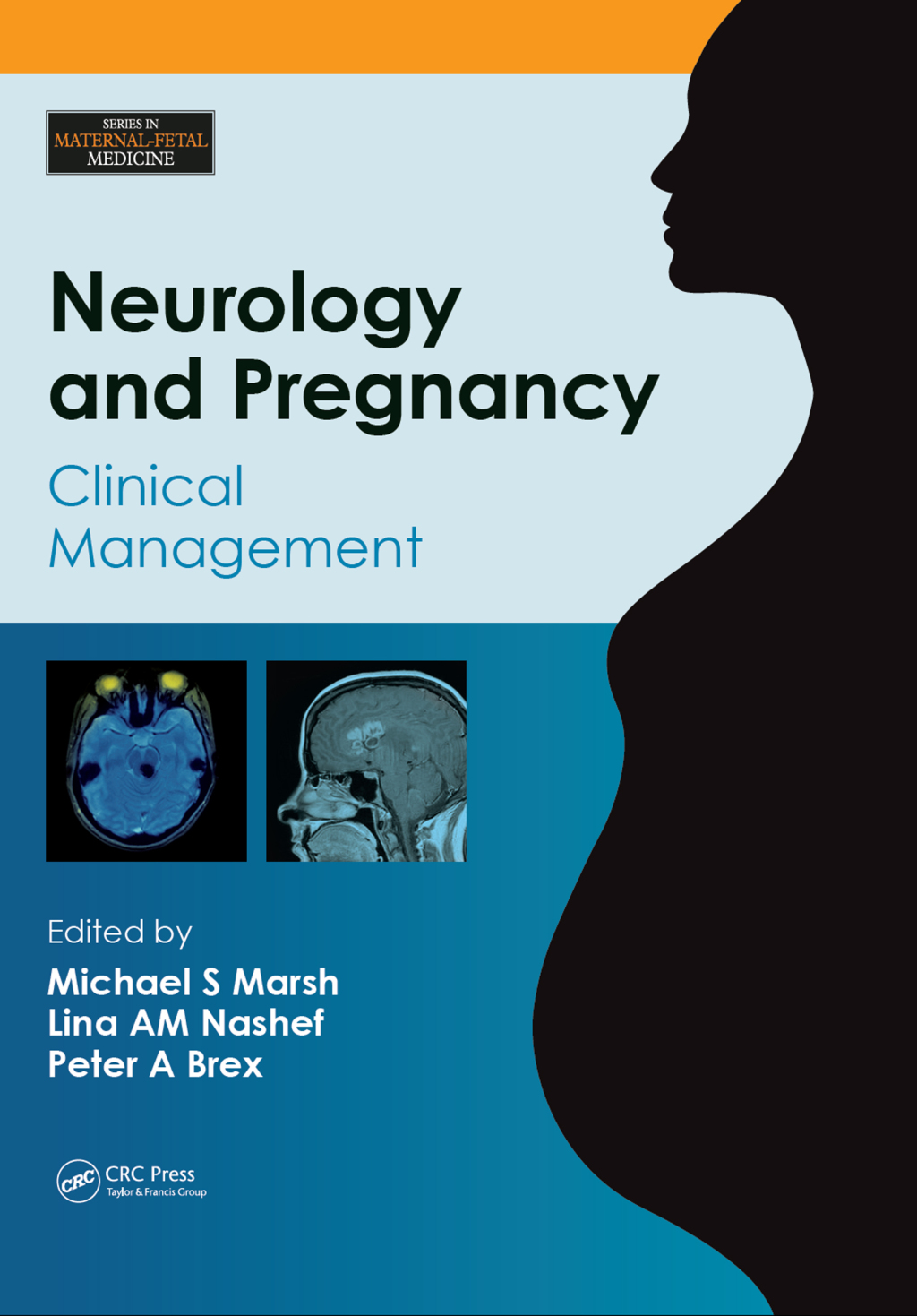 Neurology and Pregnancy Clinical Management 1st Edition â€“ PDF/EPUB Version Downloadable
