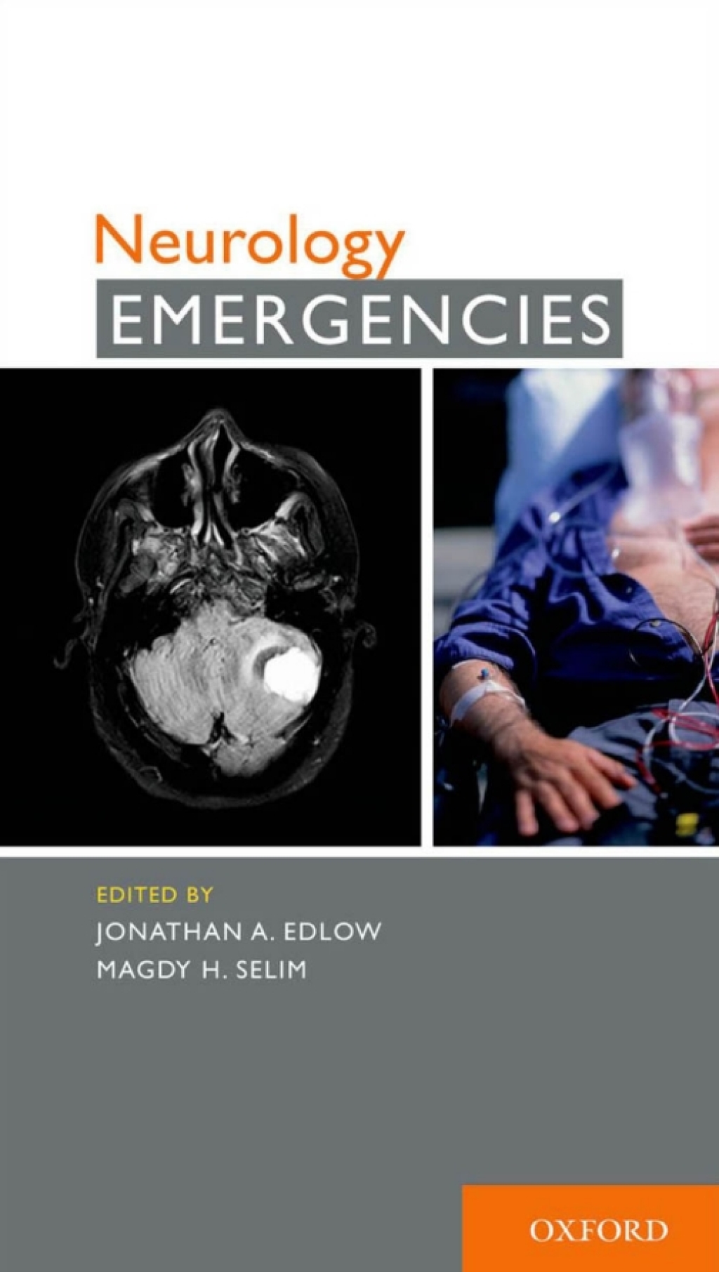 Neurology Emergencies 1st Edition â€“ PDF/EPUB Version Downloadable