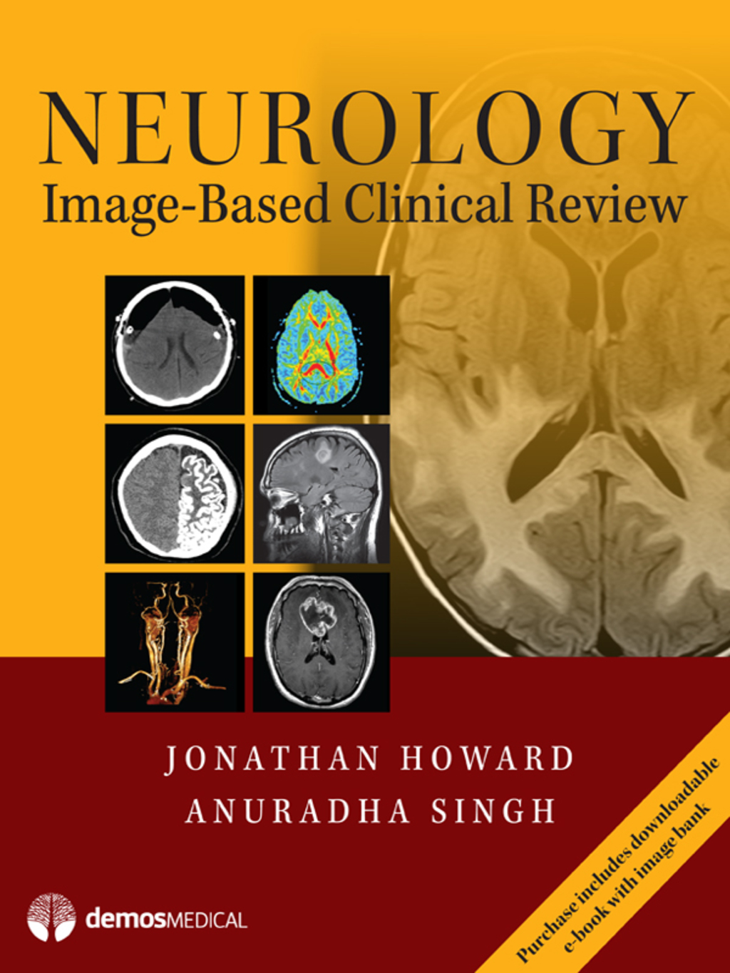 Neurology Image-Based Clinical Review 1st Edition â€“ PDF/EPUB Version Downloadable