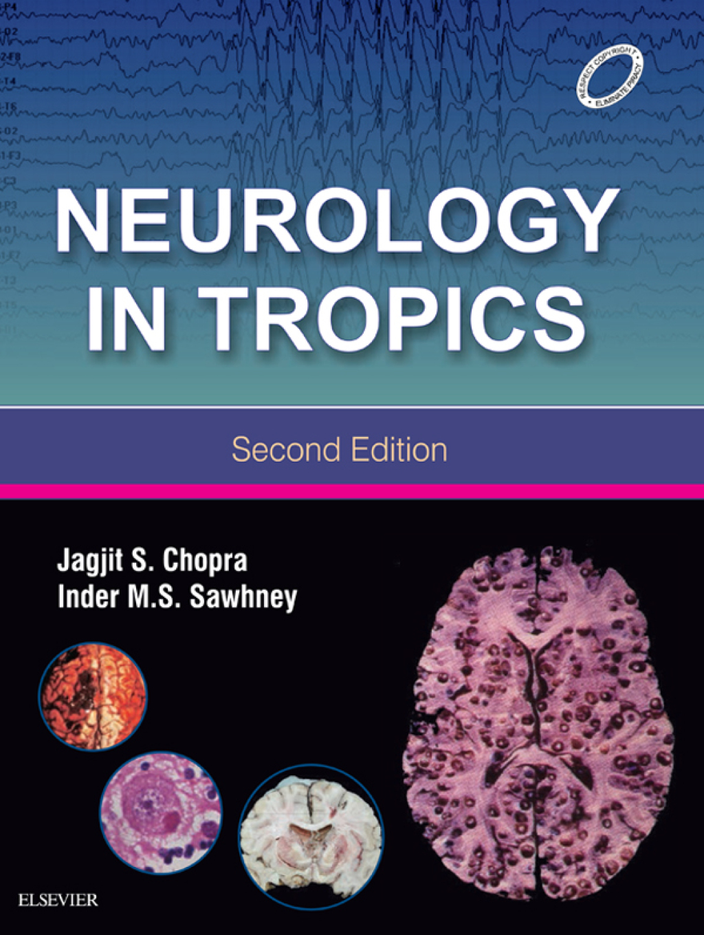 Neurology in Tropics 2nd Edition â€“ PDF/EPUB Version Downloadable