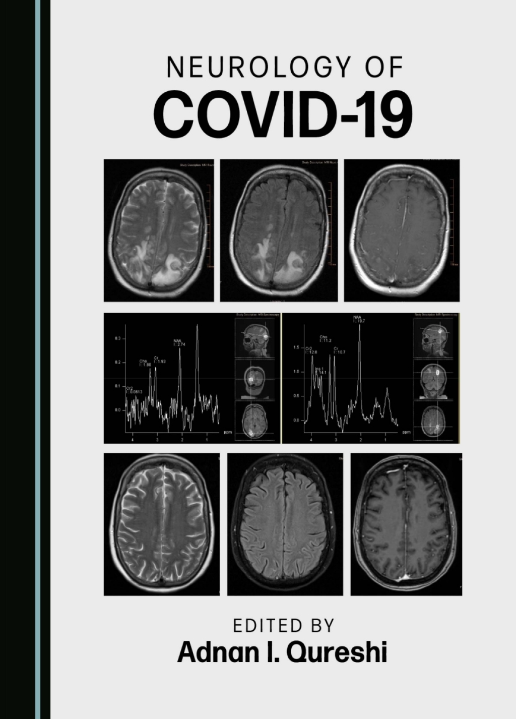 Neurology of COVID-19 1st Edition â€“ PDF/EPUB Version Downloadable