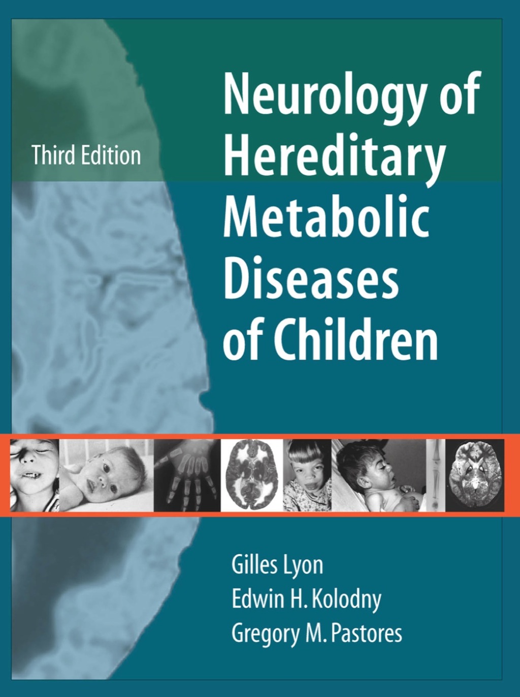 Neurology of Hereditary Metabolic Diseases of Children: Third Edition 3rd Edition â€“ PDF/EPUB Version Downloadable