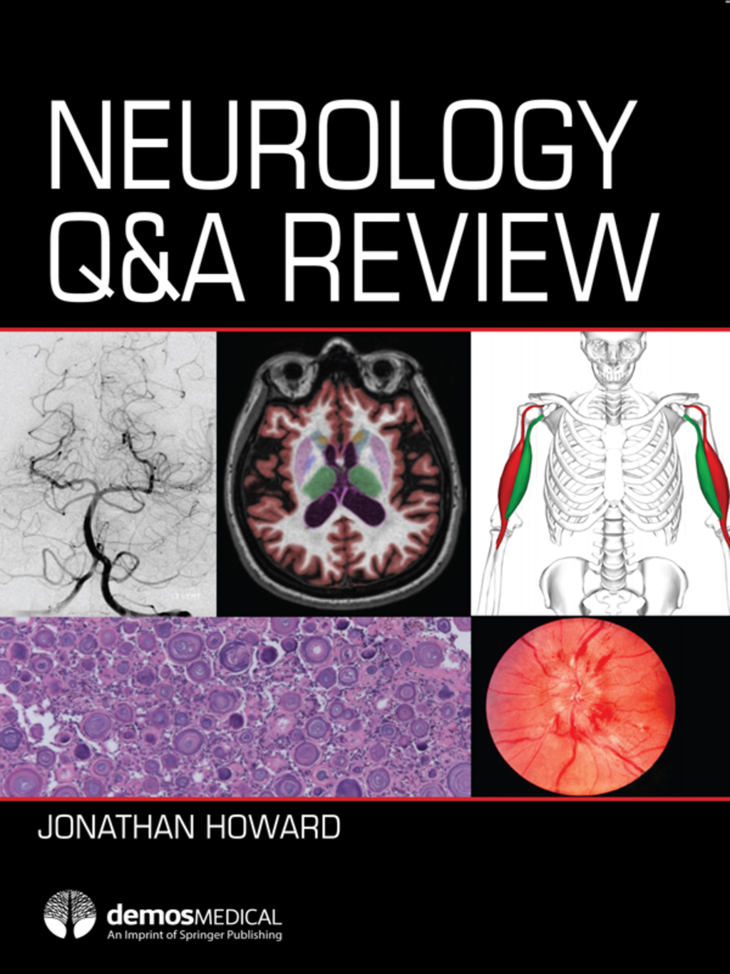 Neurology Q&A Review 1st Edition â€“ PDF/EPUB Version Downloadable