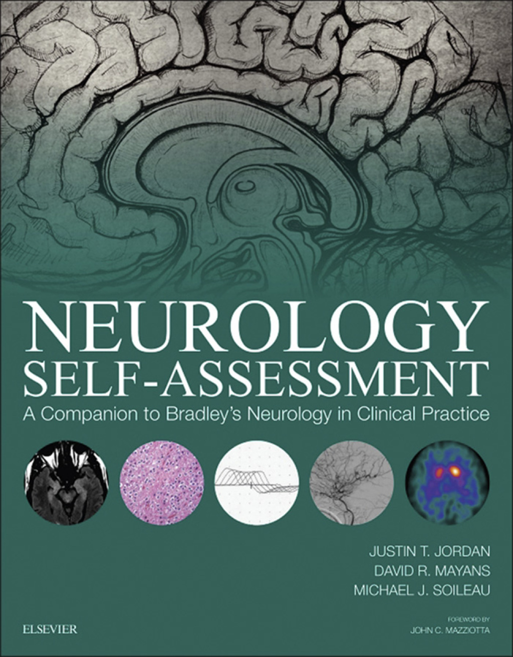 Neurology Self-Assessment: A Companion to Bradley's Neurology in Clinical Practice  â€“ PDF/EPUB Version Downloadable