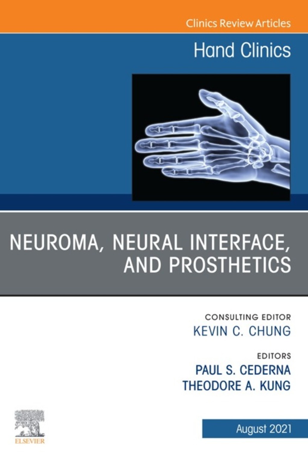 Neuroma, Neural interface, and Prosthetics, An Issue of Hand Clinics  â€“ PDF/EPUB Version Downloadable