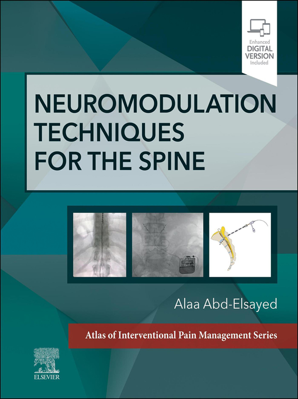 Neuromodulation Techniques for the Spine A Volume in the Atlas of Interventional Pain Management Series  â€“ PDF/EPUB Version Downloadable