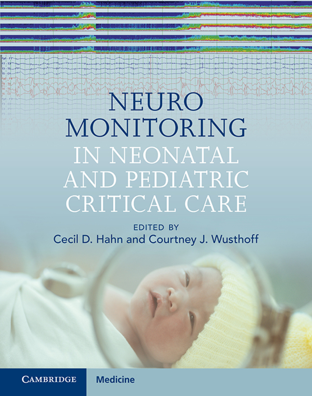 Neuromonitoring in Neonatal and Pediatric Critical Care  â€“ PDF/EPUB Version Downloadable