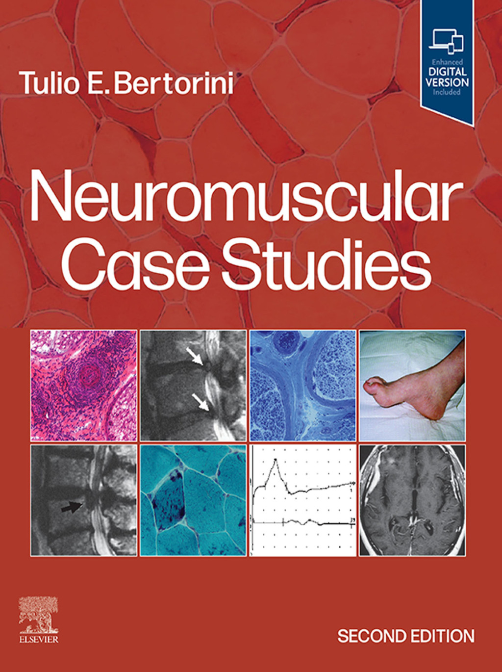 Neuromuscular Case Studies 2nd Edition â€“ PDF/EPUB Version Downloadable