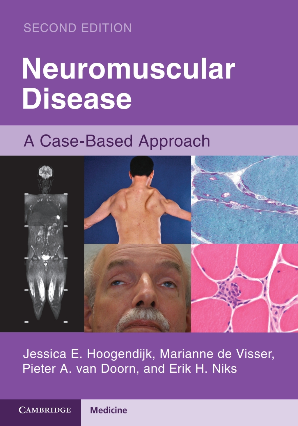 Neuromuscular Disease A Case-Based Approach 2nd Edition â€“ PDF/EPUB Version Downloadable