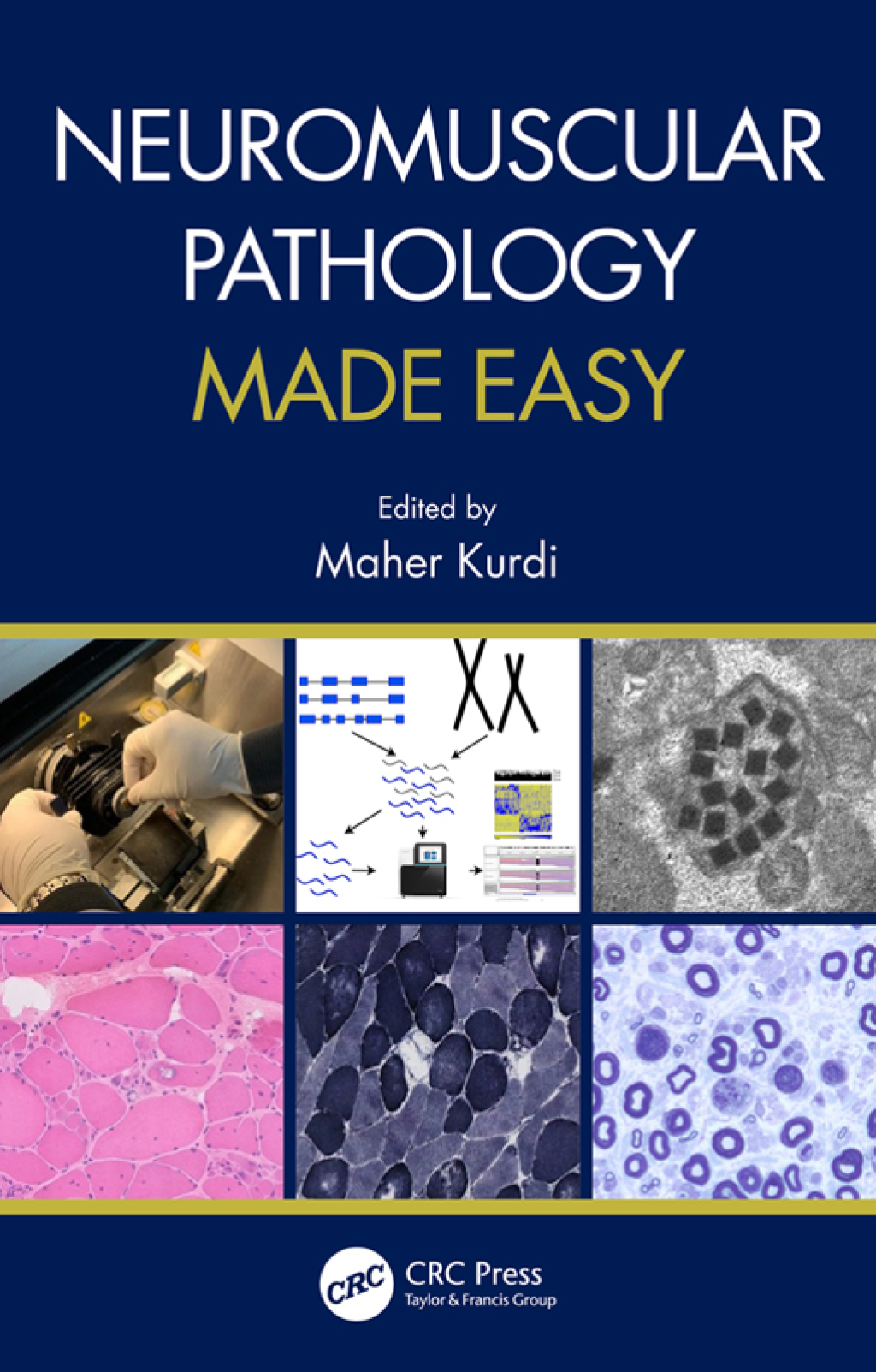 Neuromuscular Pathology Made Easy 1st Edition â€“ PDF/EPUB Version Downloadable