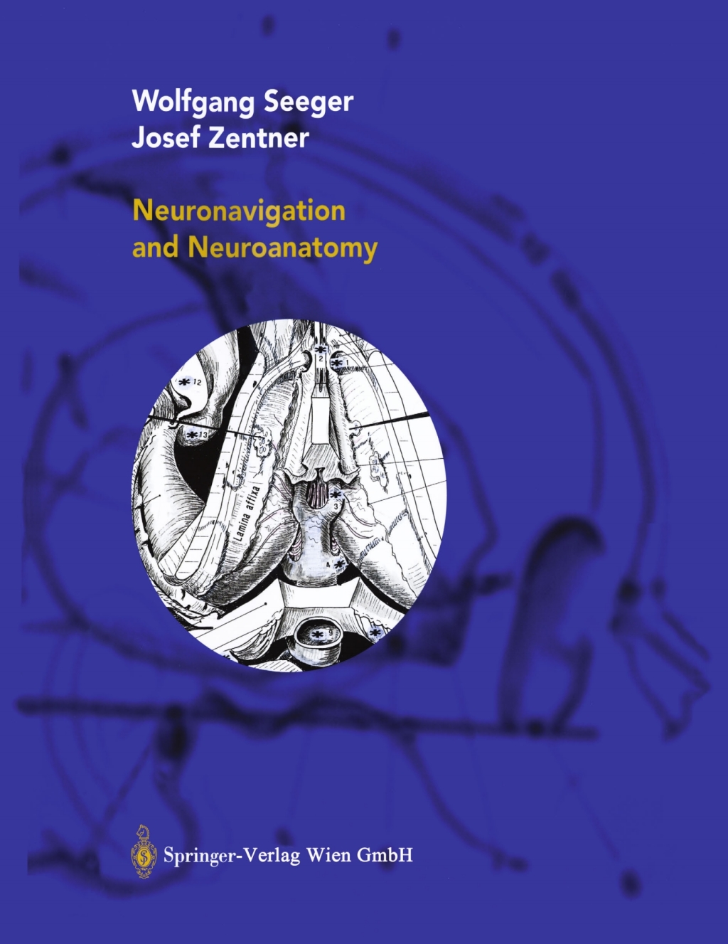 Neuronavigation and Neuroanatomy  â€“ PDF/EPUB Version Downloadable