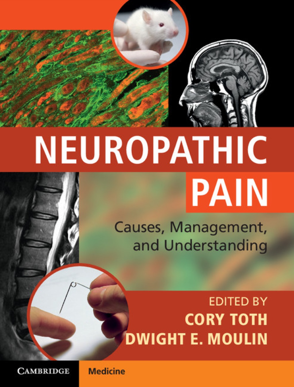 Neuropathic Pain Causes, Management and Understanding 1st Edition â€“ PDF/EPUB Version Downloadable
