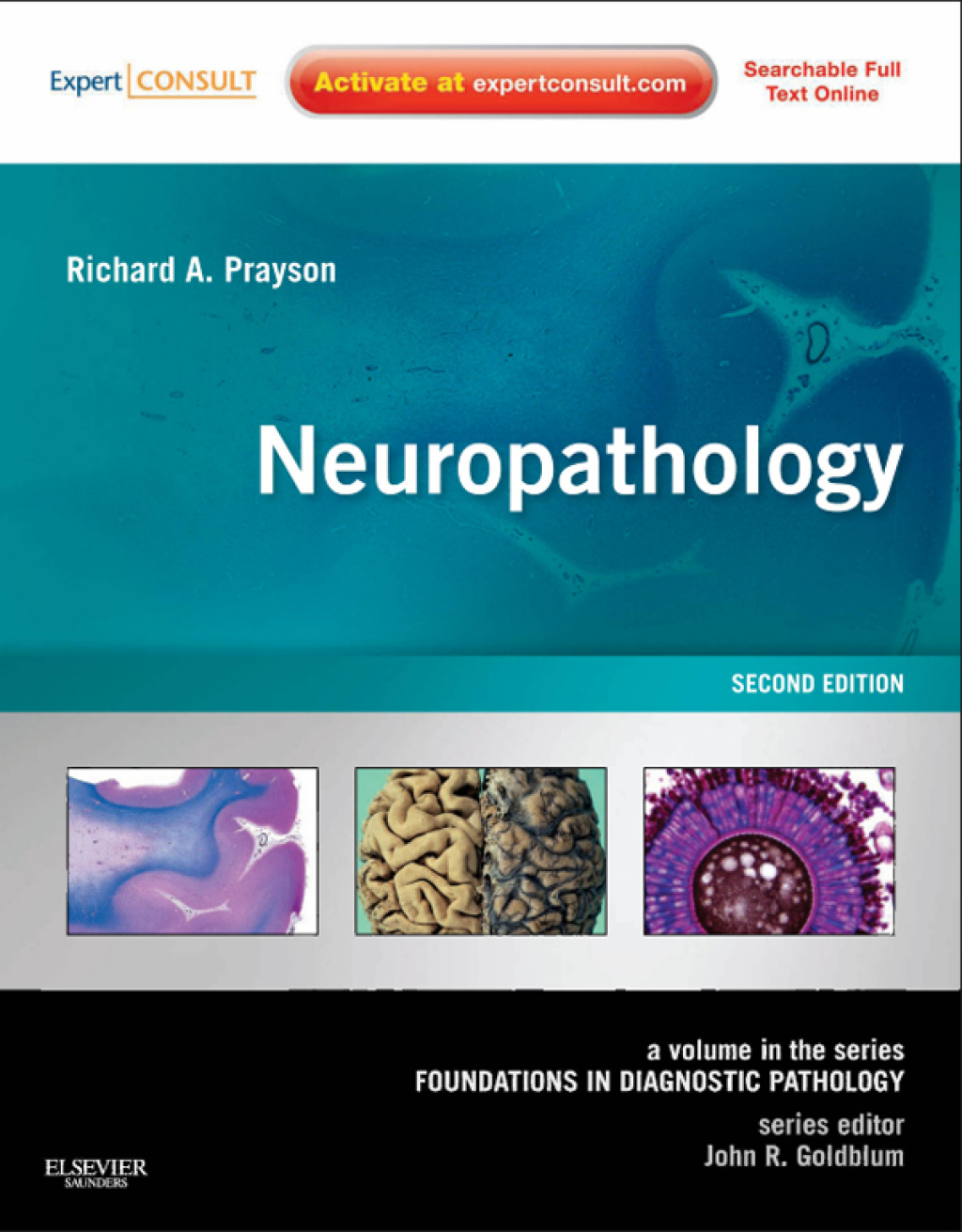 Neuropathology A Volume in the Series: Foundations in Diagnostic Pathology 2nd Edition â€“ PDF/EPUB Version Downloadable