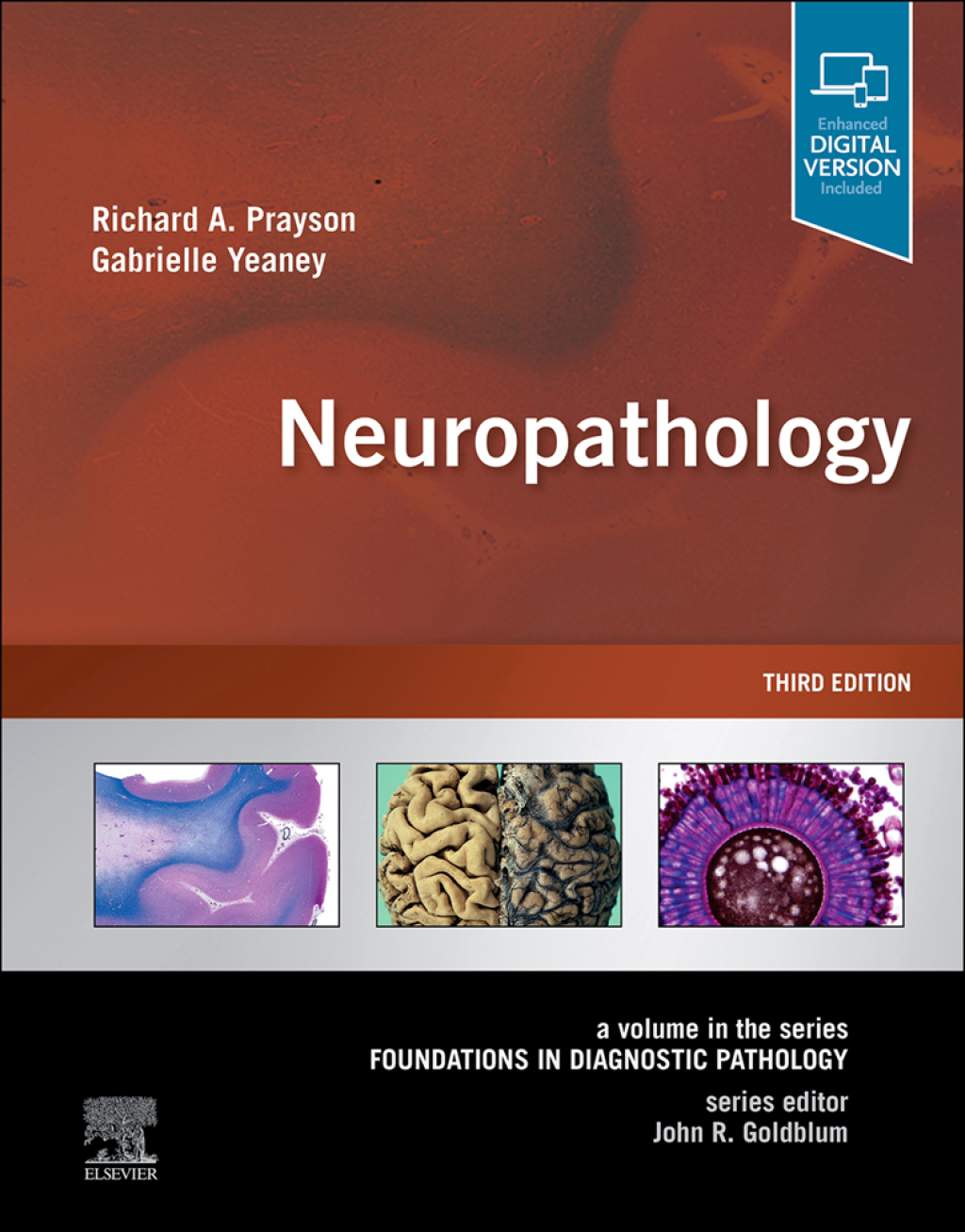 Neuropathology A Volume in the Series: Foundations in Diagnostic Pathology 3rd Edition â€“ PDF/EPUB Version Downloadable