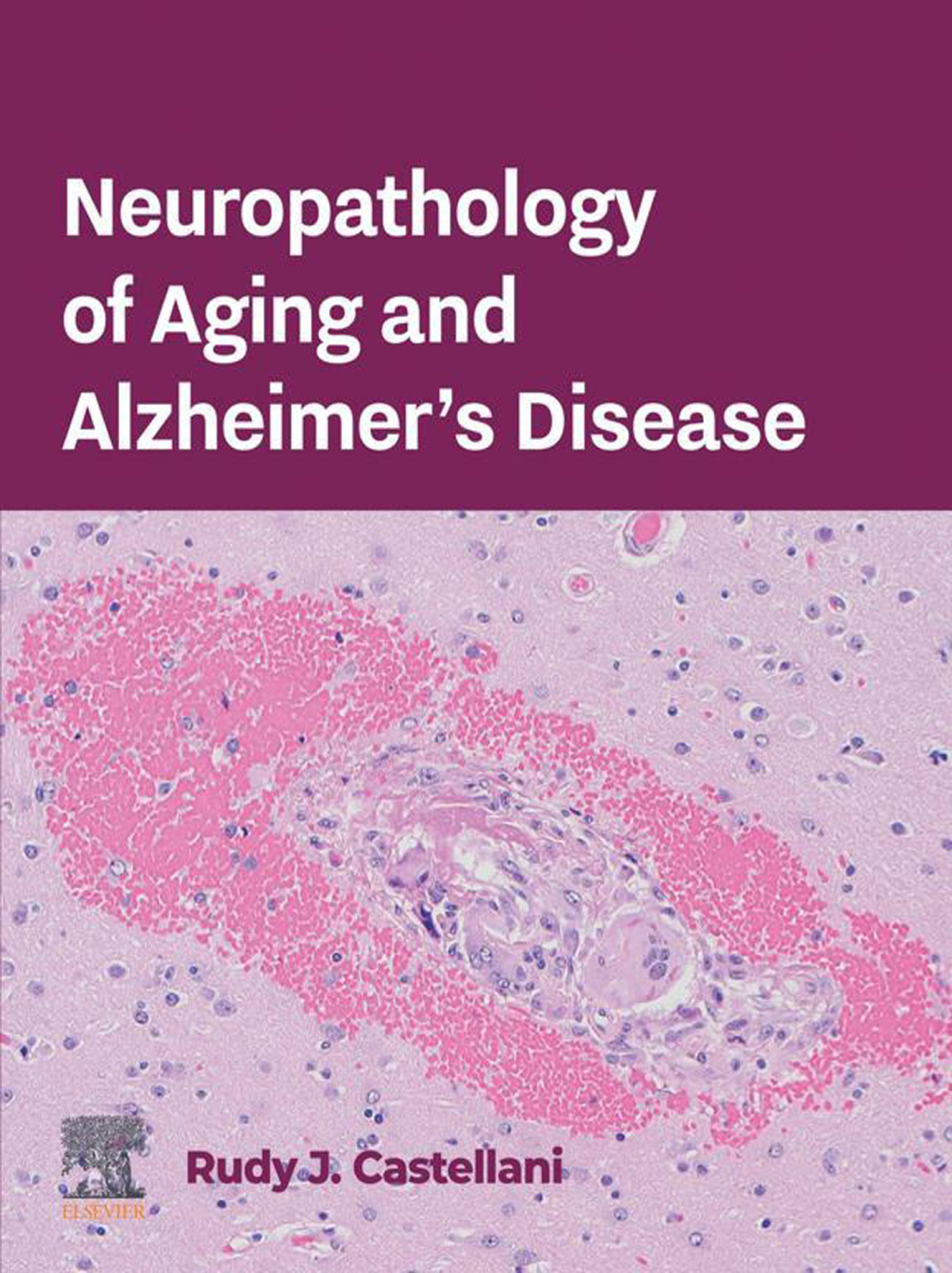 Neuropathology of Aging and Alzheimerâ€™s Disease  â€“ PDF/EPUB Version Downloadable
