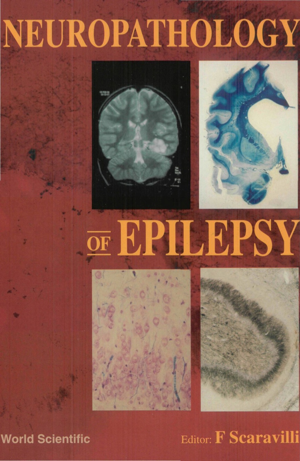 Neuropathology Of Epilepsy  â€“ PDF/EPUB Version Downloadable
