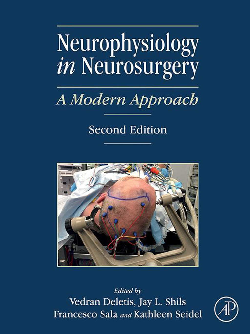 Neurophysiology in Neurosurgery A Modern Approach 2nd Edition â€“ PDF/EPUB Version Downloadable