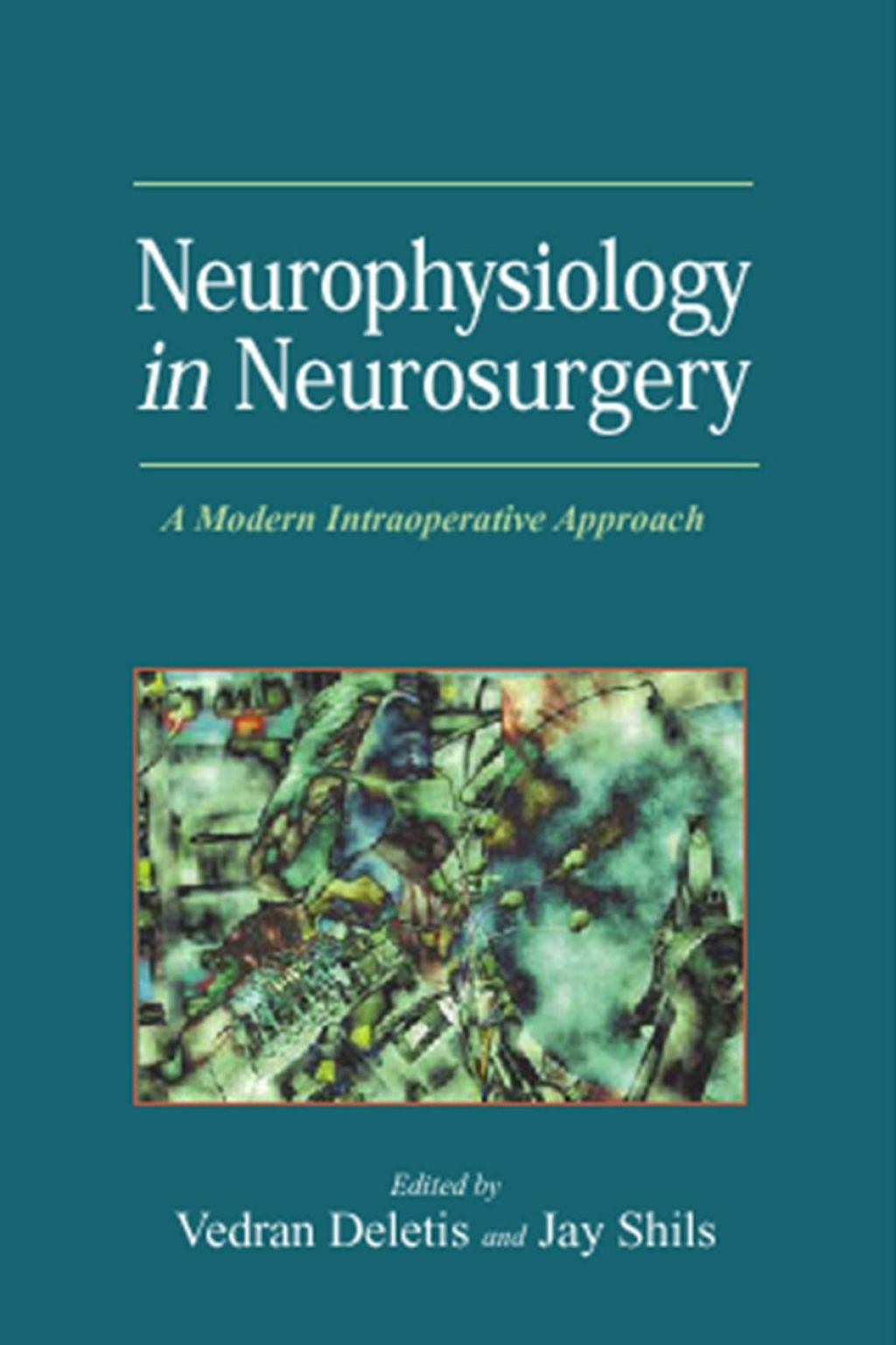 Neurophysiology in Neurosurgery: A Modern Intraoperative Approach  â€“ PDF/EPUB Version Downloadable