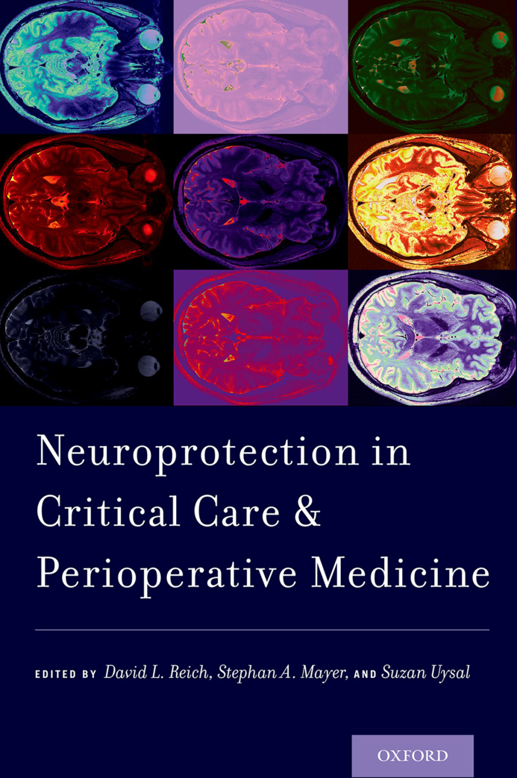 Neuroprotection in Critical Care and Perioperative Medicine 1st Edition â€“ PDF/EPUB Version Downloadable