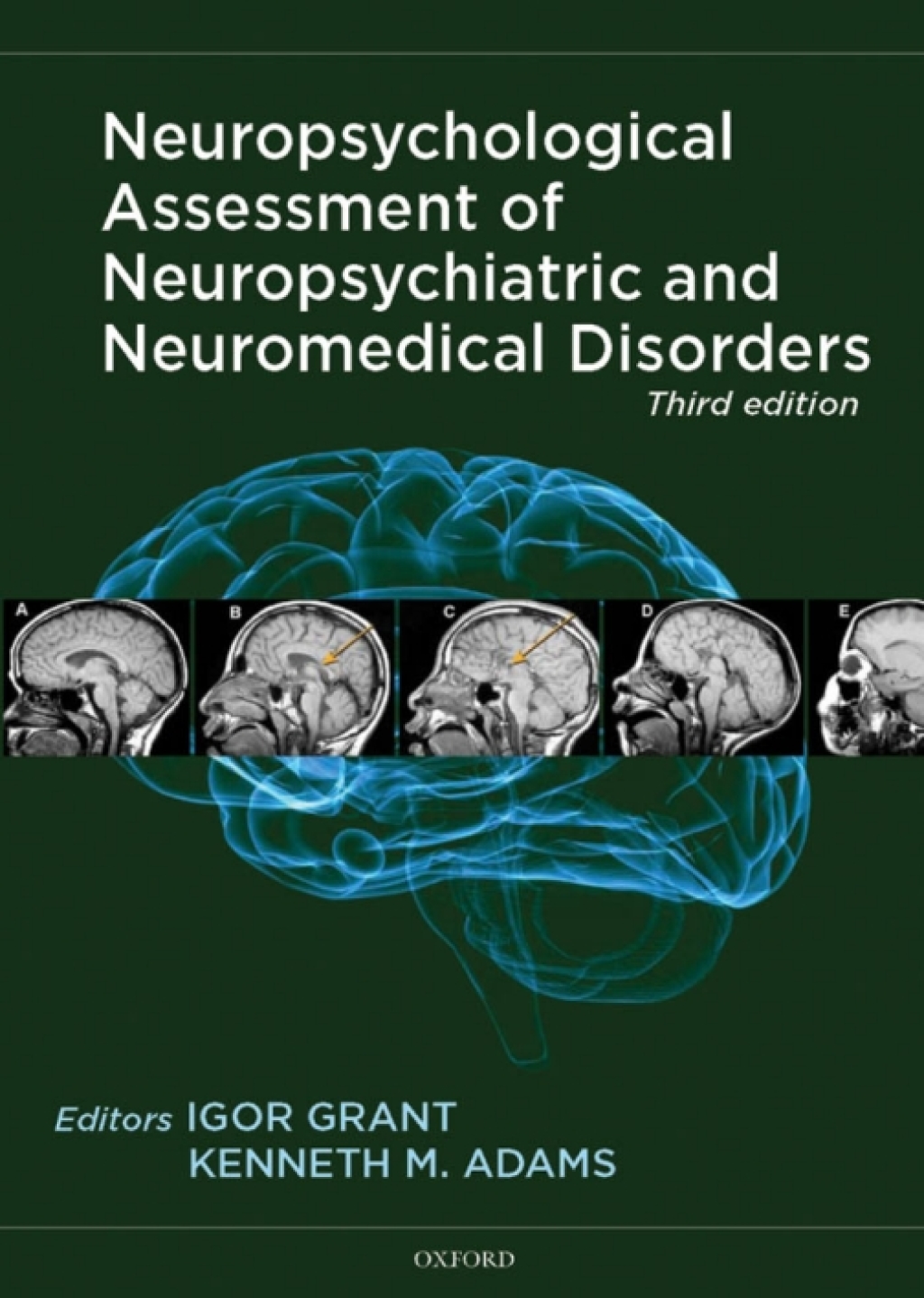 Neuropsychological Assessment of Neuropsychiatric and Neuromedical Disorders 3rd Edition â€“ PDF/EPUB Version Downloadable