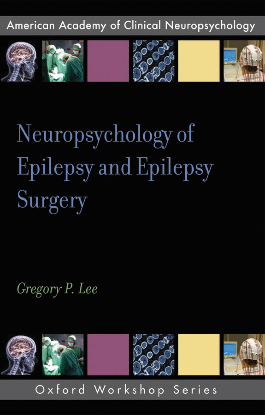 Neuropsychology of Epilepsy and Epilepsy Surgery 1st Edition â€“ PDF/EPUB Version Downloadable