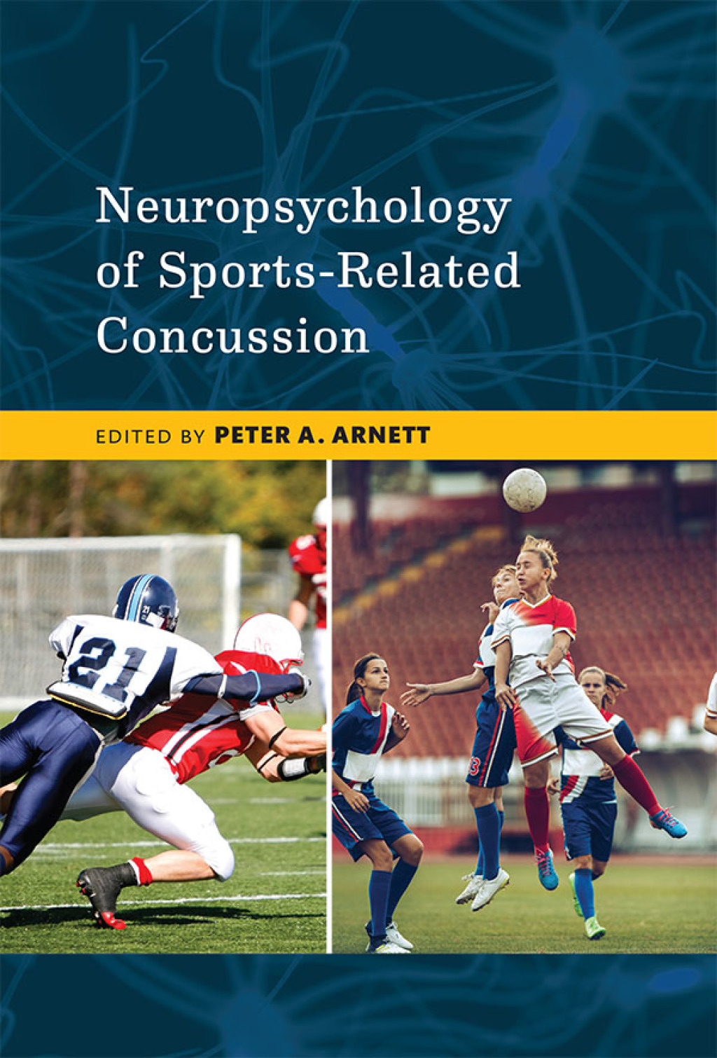 Neuropsychology of Sports-Related Concussion  â€“ PDF/EPUB Version Downloadable