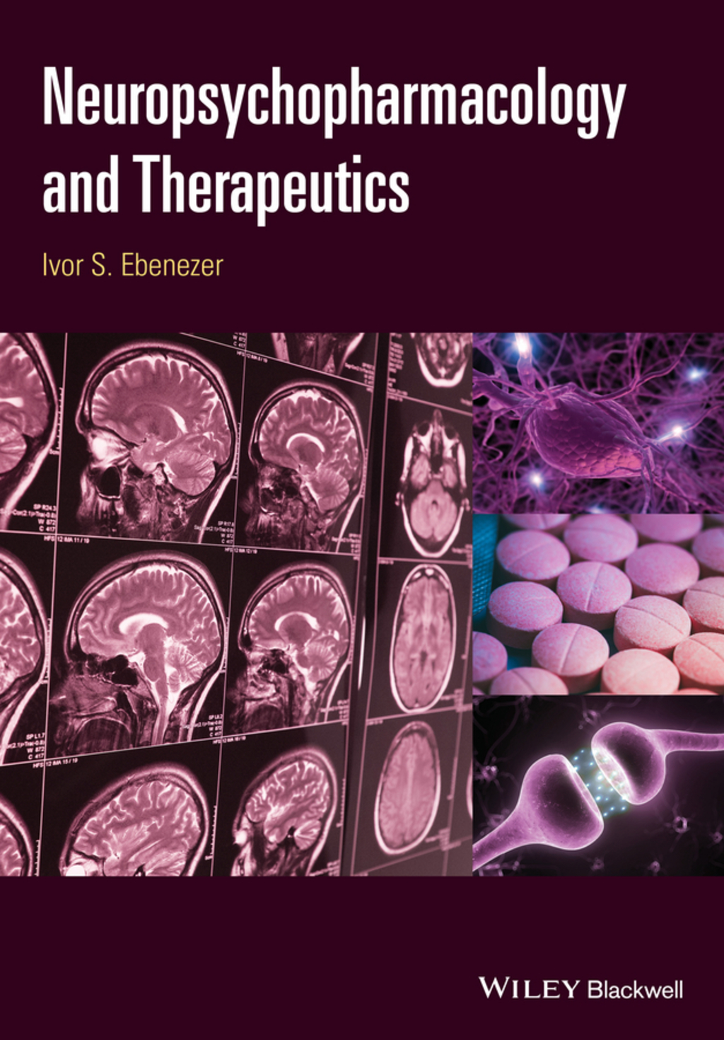 Neuropsychopharmacology and Therapeutics 1st Edition â€“ PDF/EPUB Version Downloadable
