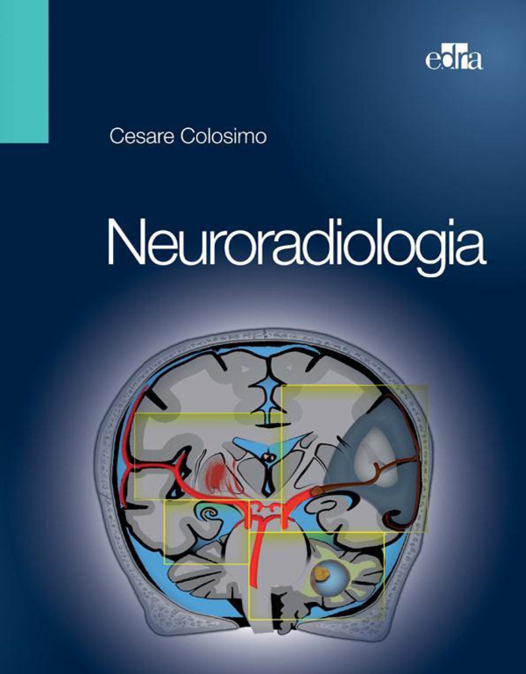 Neuroradiologia  â€“ PDF/EPUB Version Downloadable