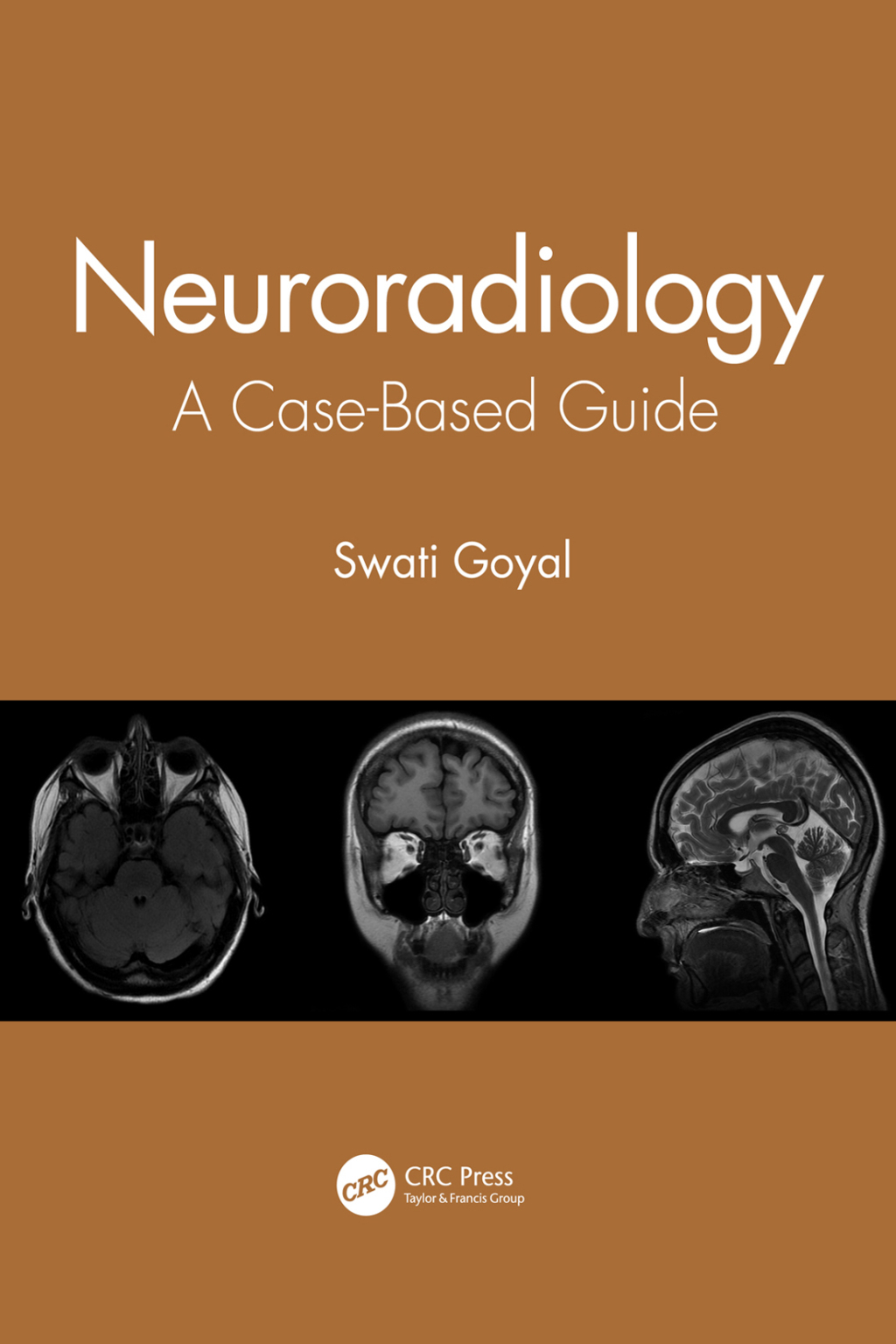 Neuroradiology A Case-Based Guide 1st Edition â€“ PDF/EPUB Version Downloadable