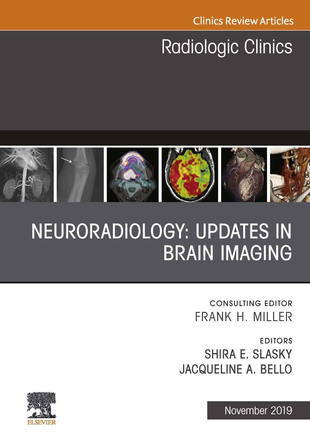 Neuroradiology, An Issue of Radiologic Clinics of North America  â€“ PDF/EPUB Version Downloadable