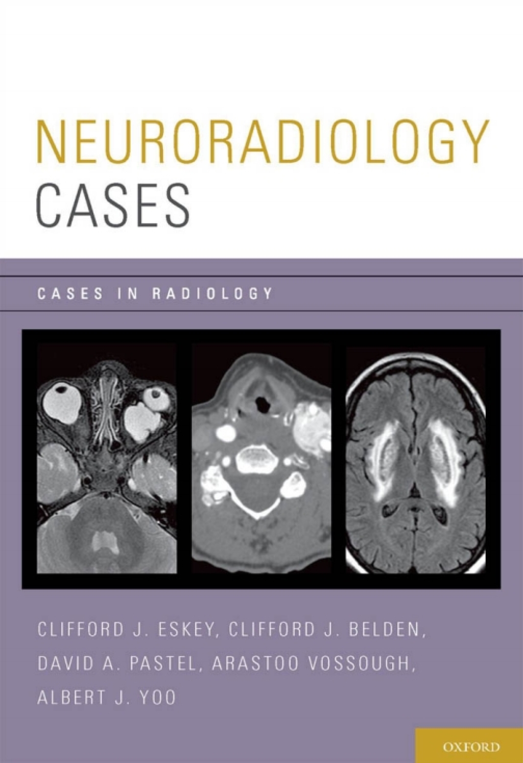 Neuroradiology Cases  â€“ PDF/EPUB Version Downloadable