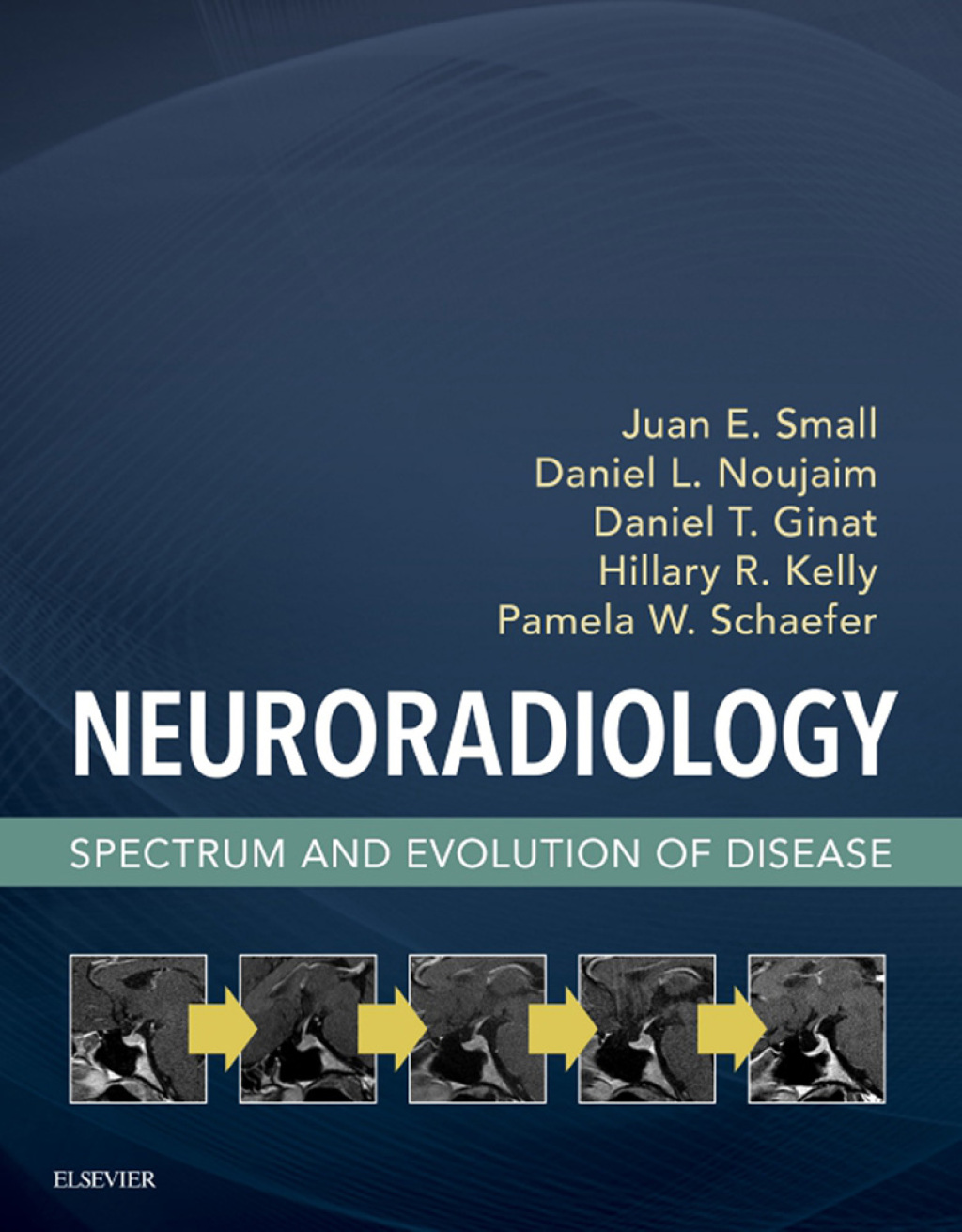 Neuroradiology - Electronic Spectrum and Evolution of Disease 1st Edition â€“ PDF/EPUB Version Downloadable