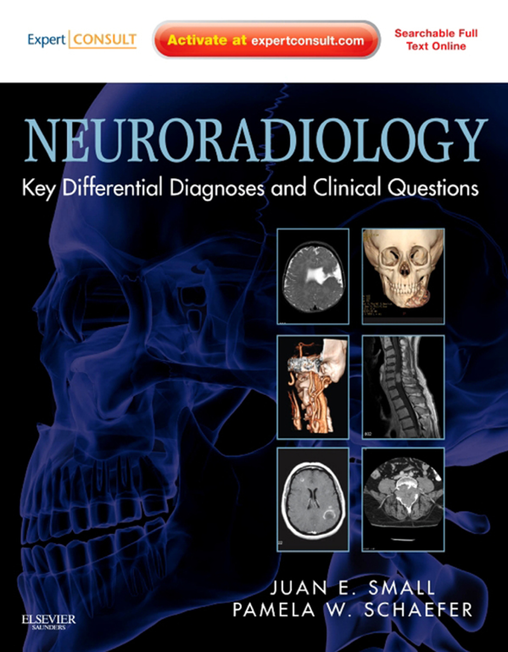 Neuroradiology: Key Differential Diagnoses and Clinical Questions 1st Edition â€“ PDF/EPUB Version Downloadable