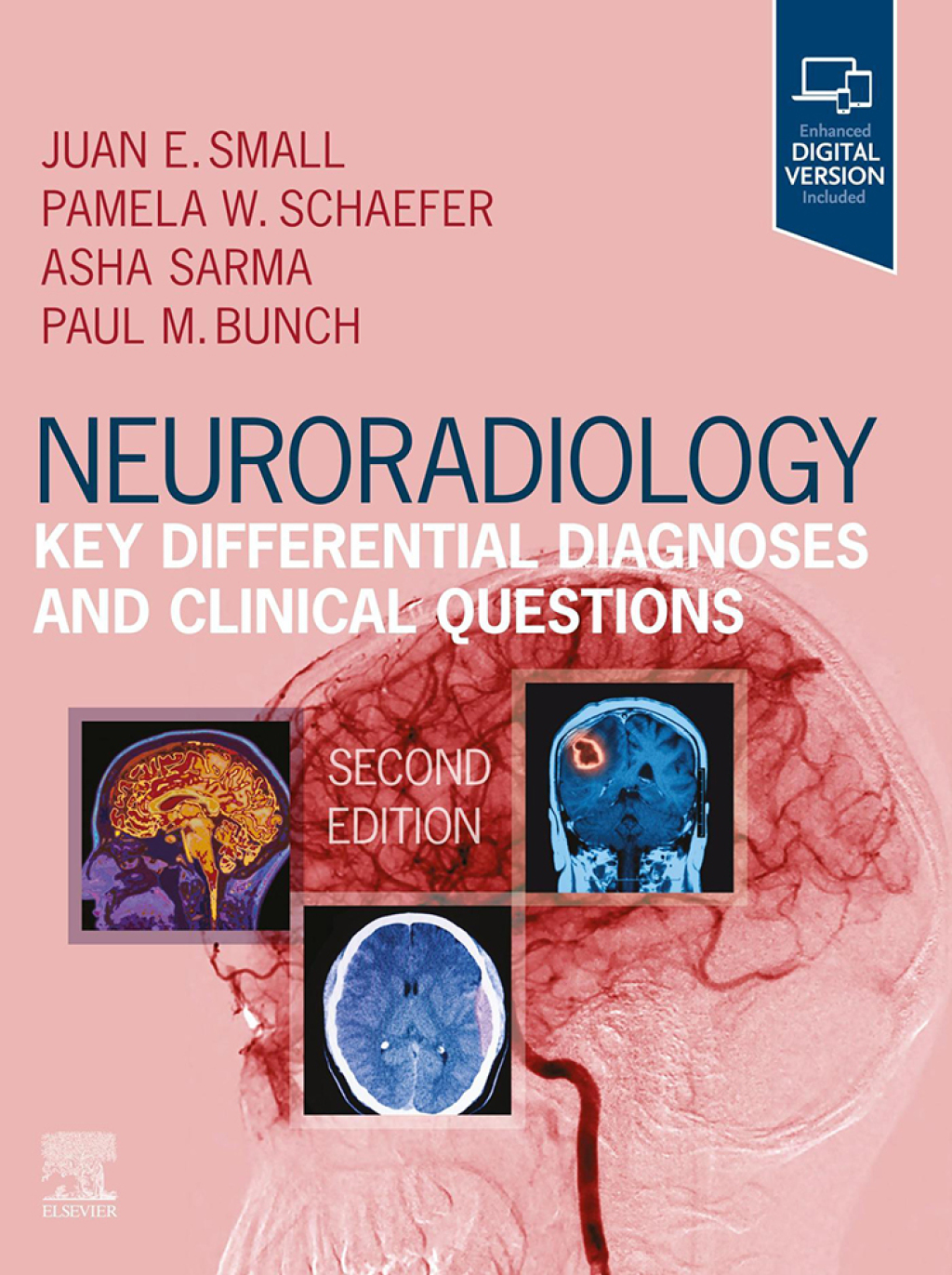 Neuroradiology: Key Differential Diagnoses and Clinical Questions 2nd Edition â€“ PDF/EPUB Version Downloadable