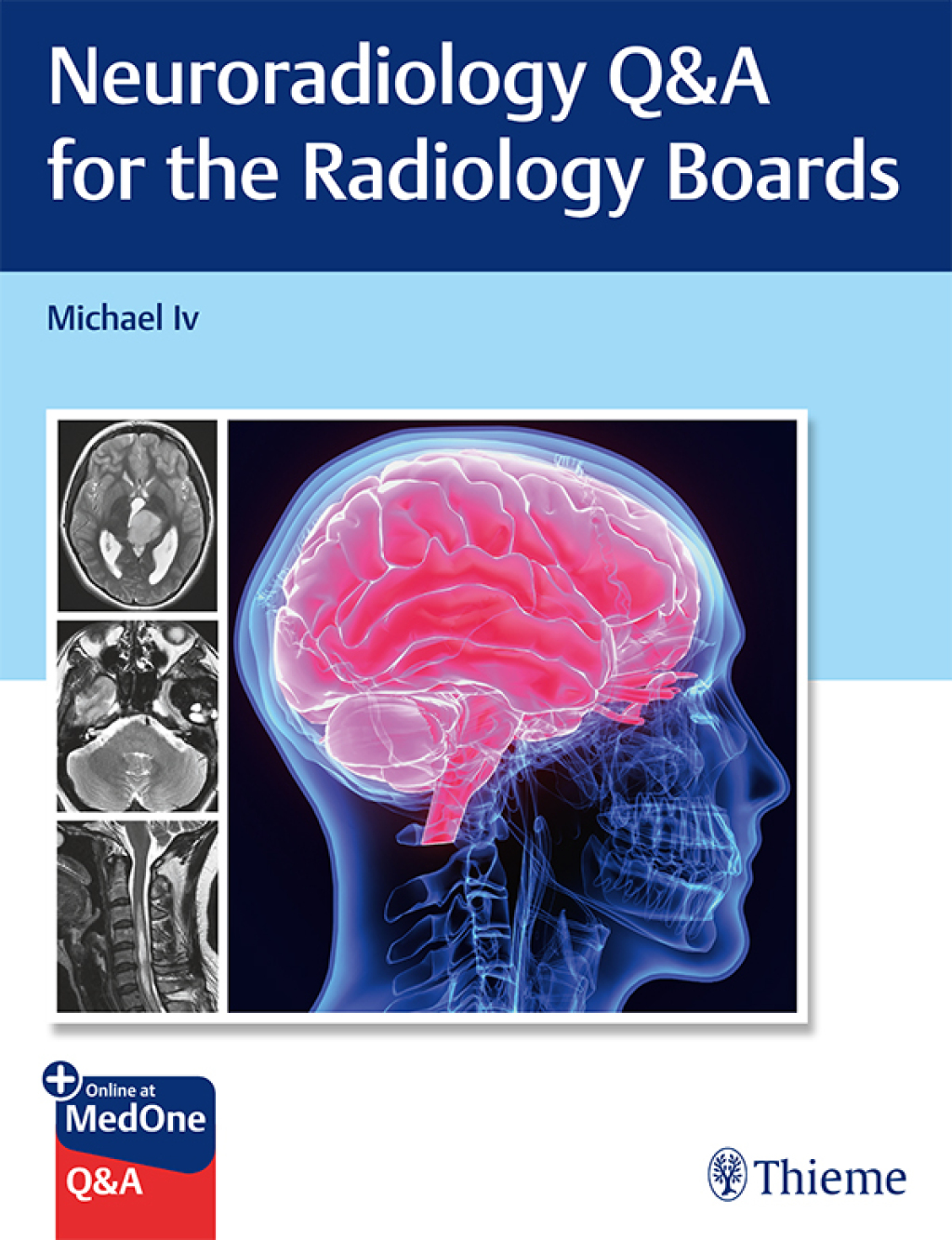 Neuroradiology Q&A for the Radiology Boards 1st Edition â€“ PDF/EPUB Version Downloadable